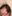 Scalp hair transplant — Mo&Line Plastic Surgery