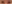 眼瞼下垂手術（目つき矯正） — プランナー美容外科クリニック