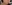 顔の脂肪吸引 — ドクター・ジョン リバンクリニック