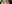 眼瞼下垂手術（目つき矯正） — セギム美容外科クリニック