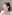 鼻の修正手術 — チャ・ミン美容外科クリニック