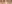 裏ハムラ法（経結膜的眼窩脂肪移動術） — プレジャー美容外科クリニック