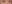 裏ハムラ法（経結膜的眼窩脂肪移動術） — SM美容外科クリニック