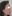 Augmentation rhinoplasty for a low/flat nasal bridge — Uri Plastic Surgery Clinic
