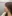 糸リフト（スレッドリフト） — TOP美容外科クリニック