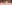 涙袋形成（脂肪注入） — ファクト美容外科クリニック