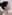 オトガイ骨削り（あご先の縮小術） — ハイエンド美容外科クリニック