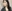 糸リフト（スレッドリフト） — ジャスト美容外科クリニック