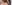 裏ハムラ法（経結膜的眼窩脂肪移動術） — マスト美容外科クリニック