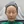 Ultracol (PDO microsphere collagen stimulator injection) — after · Project U Clinic