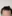 額縮小術（生え際下げ・ヘアライン下降術） — ザフィックス美容外科クリニック