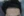 ปลูกผมบริเวณจอน — หลังทำ (112วัน) · คลินิก Richmoa แถวอับกูจอง