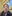 Full zygoma reduction (zygomatic body + arch osteotomy) — Uri Plastic Surgery Clinic