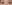 涙袋形成（脂肪注入） — ファクト美容外科クリニック