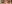 二重まぶた（自然癒着法） — プロミス美容外科クリニック