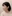 二重まぶた（自然癒着法） — アウラ美容外科クリニック