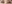 二重まぶた（自然癒着法） — アウラ美容外科クリニック
