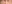 裏ハムラ法（経結膜的眼窩脂肪移動術） — セギム美容外科クリニック