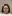 裏ハムラ法（経結膜的眼窩脂肪移動術） — ハッシュ美容外科クリニック