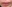 人中短縮（リップリフト） — ドクタータク美容外科クリニック