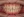 Metal bracket braces (traditional fixed orthodontics) — before (115days) · Yeonse Bareun Dental Clinic