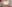 お腹の脂肪溶解注射 — 清潭My美容外科