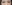 裏ハムラ法（経結膜的眼窩脂肪移動術） — プレジャー美容外科クリニック