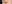 眼瞼下垂手術（目つき矯正） — ハッシュ美容外科クリニック