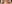 二重まぶた（自然癒着法） — ダビダ美容外科クリニック