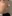 鼻の修正手術 — BT美容外科クリニック