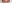 裏ハムラ法（経結膜的眼窩脂肪移動術） — ジャスト美容外科クリニック
