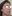 Augmentation rhinoplasty for a low/flat nasal bridge — Uri Plastic Surgery Clinic
