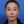 印第安纹玻尿酸填充 — 术后 (30天) · La Bom医美诊所