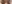 二重まぶた（自然癒着法） — プロミス美容外科クリニック