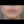 Full-face filler (full-face HA rejuvenation) — before · On Air Plastic Surgery Clinic
