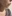 顔の脂肪溶解注射（小顔注射） — ロリポップ美容外科クリニック