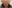 Facial liposuction — OnYu Plastic Surgery Clinic