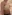 豊胸術（シリコンインプラント／人工乳腺） — バナナ美容外科クリニック