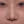 ผ่าตัดแก้ไขผนังกั้นช่องจมูกคด (Septoplasty) — หลังทำ (14วัน) · คลินิกโคบิจู