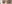 二重まぶた（自然癒着法） — ルホ美容外科クリニック
