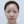 Eyelid filler (upper eyelid hollowing correction) — before · Galaxy Plastic Surgery Clinic