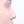 revision rhinoplasty — before (7days) · Sugar Plastic Surgery