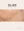 RevLite SI (Q-switched Nd:YAG laser toning) — after (120days) · Glad Plastic Surgery