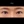 ผ่าตัดแก้ขนตาทิ่มตา (ขนตาแยงตา / เปลือกตาม้วนเข้า) — ก่อนทำ (14วัน) · รพ.ศัลยกรรมตกแต่งโอลโล