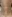 リズネ（ポリヌクレオチド／サーモンDNA注射・スキンブースター） — ユーアンドアイクリニック-江南店