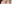 裏ハムラ法（経結膜的眼窩脂肪移動術） — IK美容外科クリニック