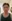 Bulbous nose correction (surgical nasal tip reduction) — Eight Plastic Surgery Clinic