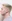 Lateral canthoplasty (outer corner opening) — Eight Plastic Surgery Clinic