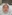 Rejuran Healer (salmon-DNA polynucleotide / PN skin booster) — Mochi Clinic