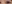 二重まぶた（自然癒着法） — アイフィット美容外科クリニック